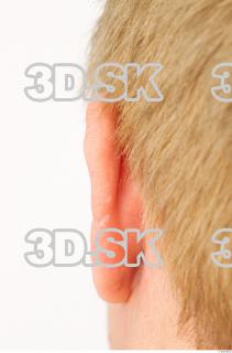 Ear texture of Pat 0003